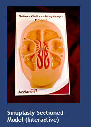 Sinuplasty Sectioned Model (interactive)
