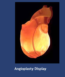Angioplasty Display