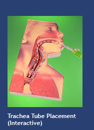 Trachea Tube Placement (interactive)