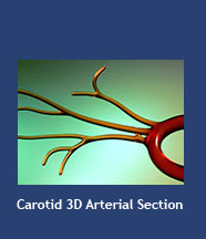 Carotid 3D Arterial Section