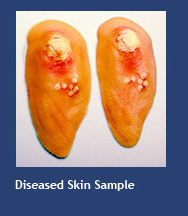 Diseased Skin Sample