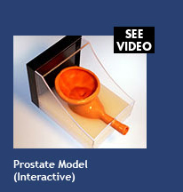 Prostate Model (interactive)