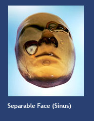 Separable Face (sinus)