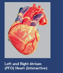 Left and Right Atrium (PFO) Heart (interactive)