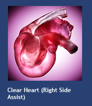 Clear Heart (right-side assist)