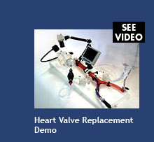 Heart Valve Replacement Demo