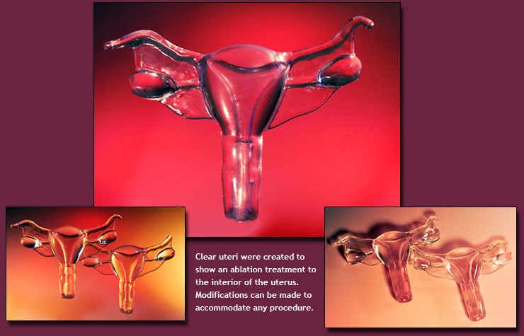 Clear Uterus