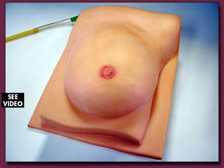 Mastectomy Breast Model