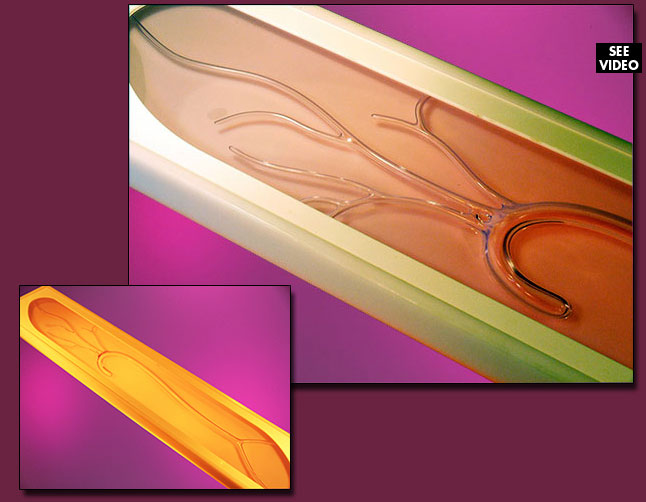 Carotid Show Case