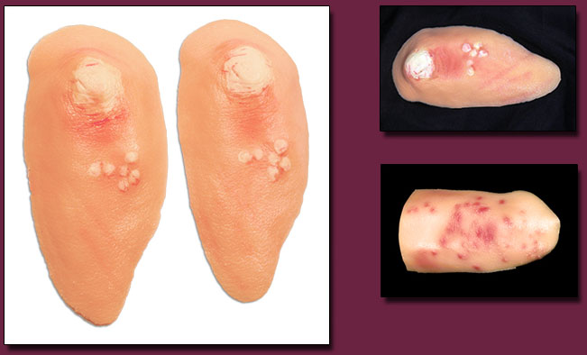 Diseased Skin Sample