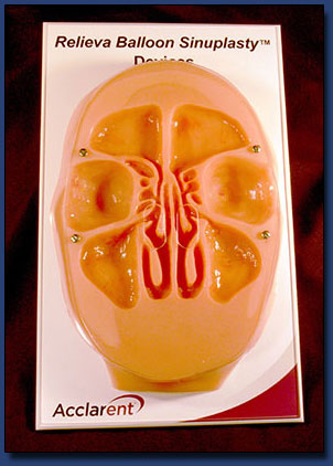Sinuplasty Sectioned Model