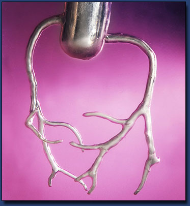 Cardiovascular Block