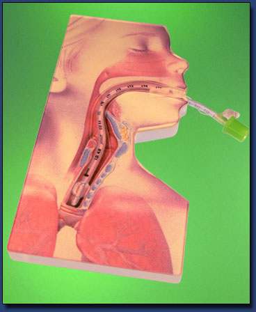 Trachea Tube Placement