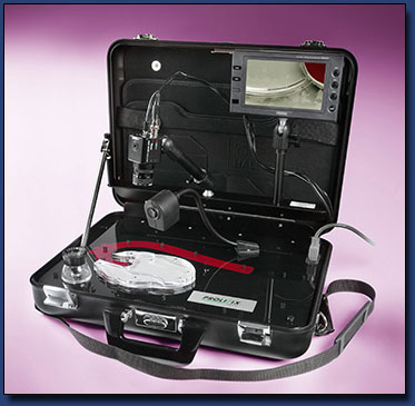 Portable Atherectomy Demo Case