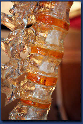 Clear Vertebrae