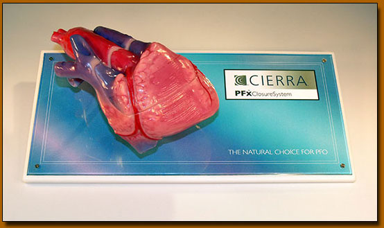 PFO Heart Model